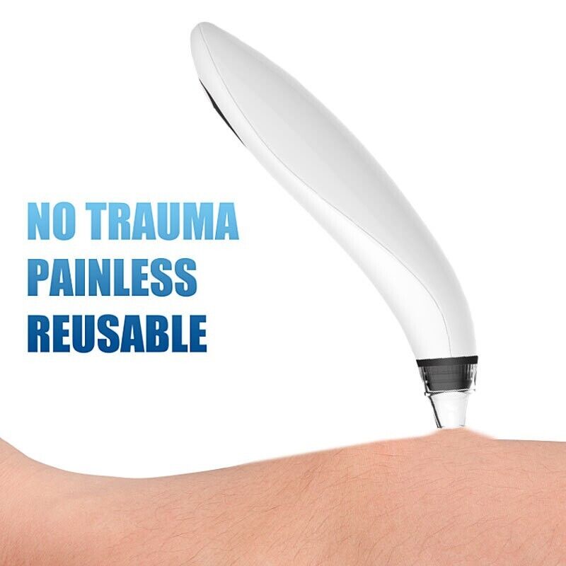 Electric Blackhead Remover Cleaner Face Diamond Pore Vacuum Suction